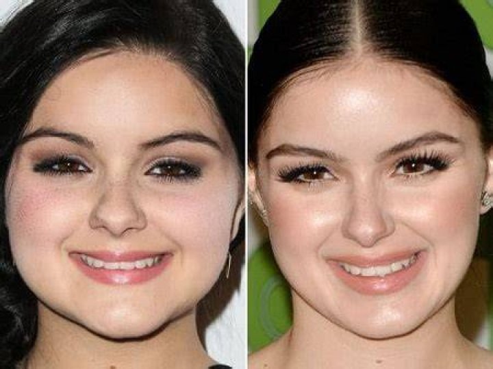 Ariel Winter Plastic Surgery Before and After