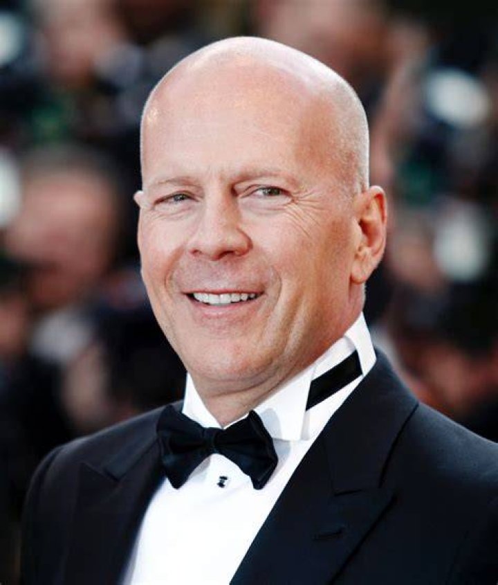 Famous Bald People